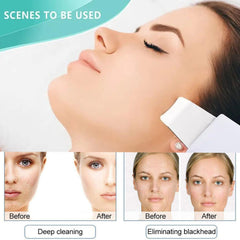Hydrogen and Oxygen Small Bubble Beauty Instrument Hydro facial machine