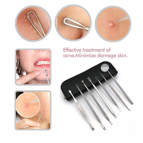 Acne Tool Removal Kit - GreenLife-5012023