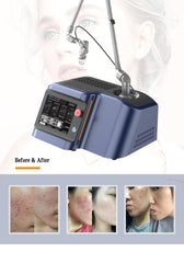 Ageless CO2 Fractional Laser Machine 40W RF Tube Scar Removal Vaginal Tightening Rejuvenation Laser Machine
