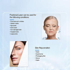Ageless CO2 Fractional Laser Machine 40W RF Tube Scar Removal Vaginal Tightening Rejuvenation Laser Machine